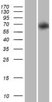 Human PRR5-ARHGAP8 Protein (Over-Expression Lysate Myc-DDK (Flag))