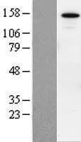 SIN3B Protein (Over-Expression Lysate Myc-DDK (Flag))