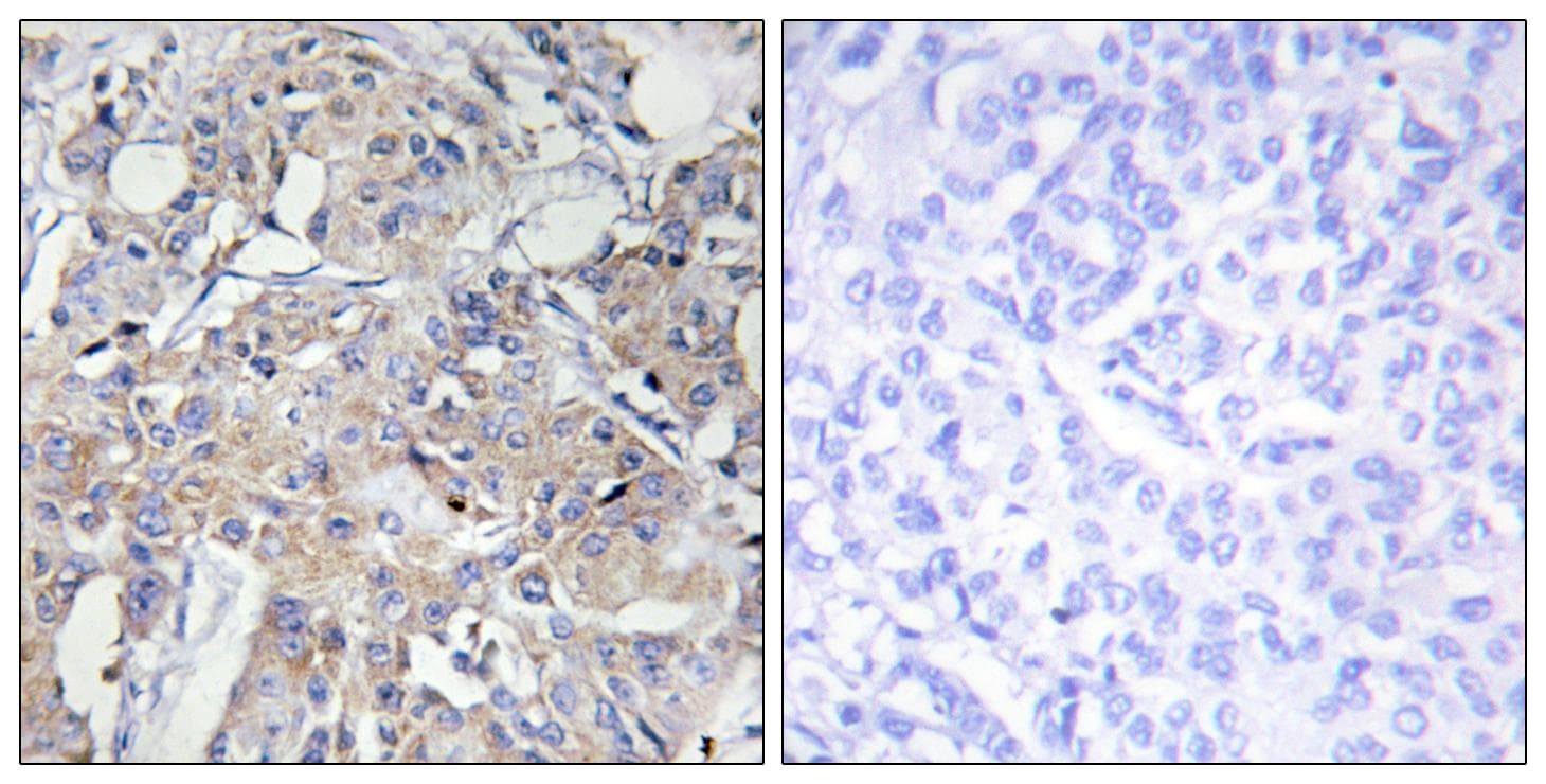 COL6A3 / Collagen VI Alpha 3 Antibody