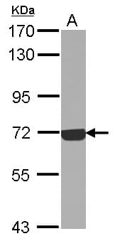Complement C9 Antibody (Internal)