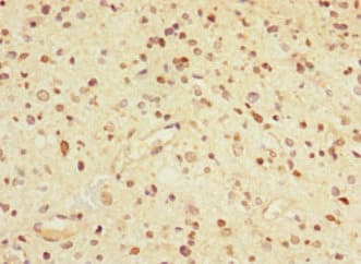 Polyclonal Rabbit anti-Human GABRA5 Antibody (IHC)