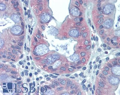IHC-plus™ ADH7 Antibody (clone 2D11)