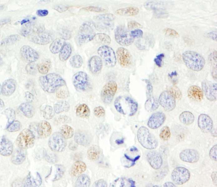 p14ARF / CDKN2A Antibody (aa75-125)
