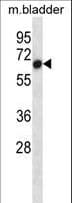 ALK2 / ACVR1 Antibody (aa137-166)