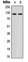ACLY / ATP Citrate Lyase Antibody (Internal)