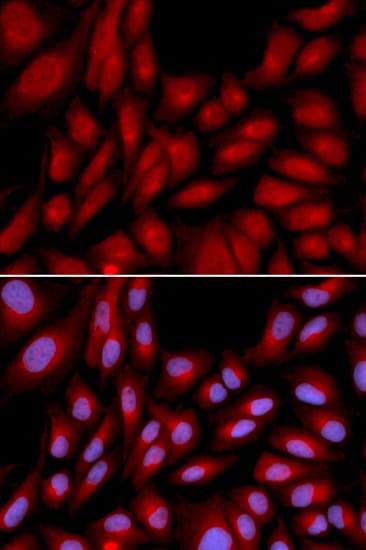 BAG1 / BAG-1 Antibody