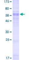 Human SLC37A4 / G6PT Protein (Recombinant GST)