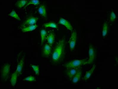 KIND2 / FERMT2 Antibody