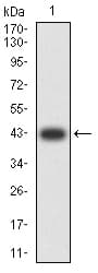 ATP2A1 / SERCA1 Antibody (clone 4F11F6)