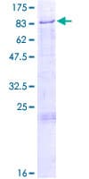 Human GLCE Protein (Recombinant GST)