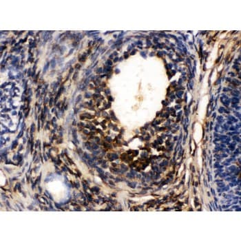 Polyclonal Rabbit anti-Human TCP1 Antibody (aa515-551, IHC, WB)