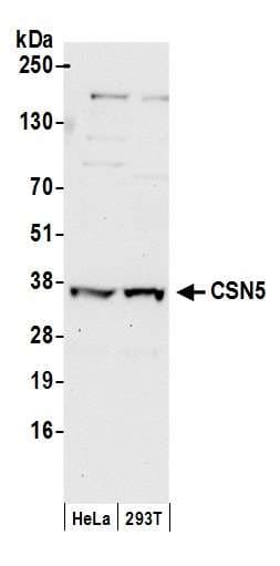 COPS5 / JAB1 Antibody (aa175-225)