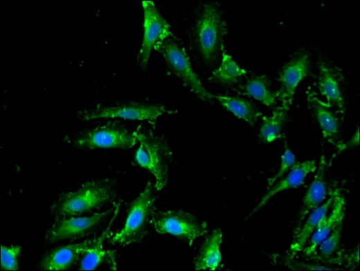 PLD1 / Phospholipase D1 Antibody