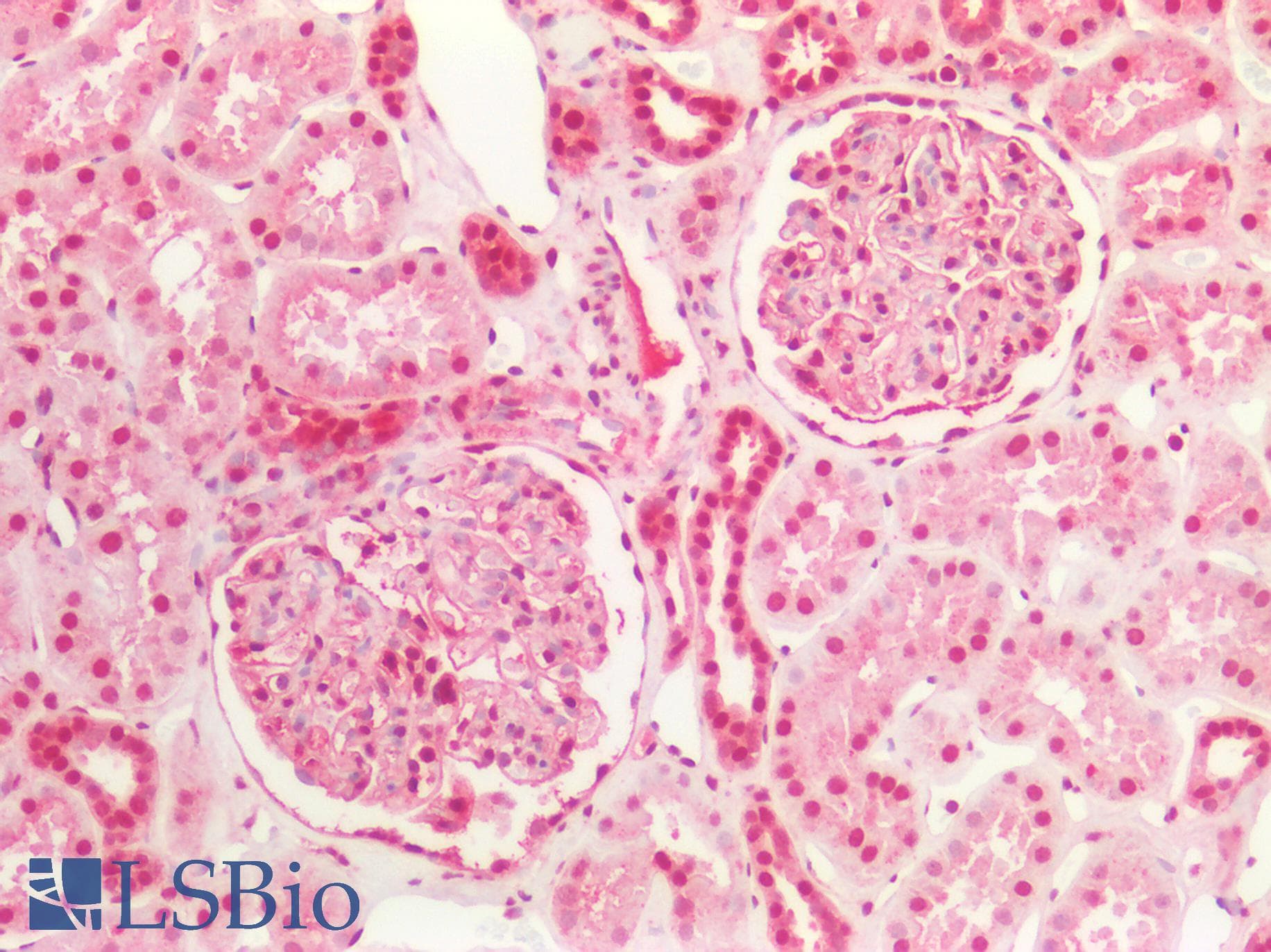 PathPlus™ Polyclonal Rabbit anti-Human HNRNPK / hnRNP K Antibody (aa380-430, IHC)