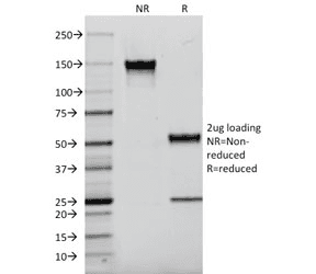 AIF1 / IBA1 Antibody (clone AIF1/2493)