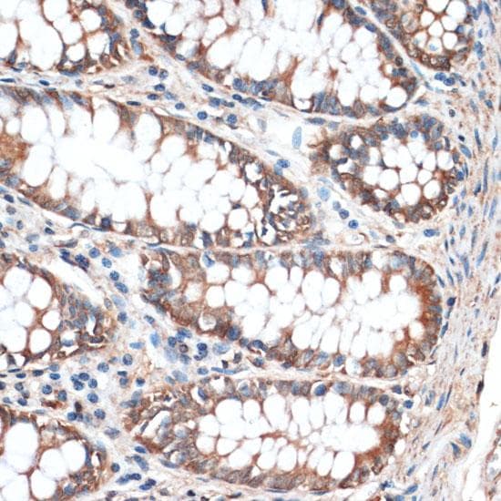 AQP4 / Aquaporin 4 Antibody