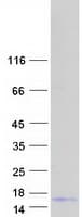 Human KRTAP3-2 Protein (Recombinant Myc-DDK (Flag))