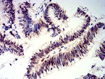 Monoclonal Mouse anti-Human CIRP / CIRBP Antibody (clone 6E12D5, IHC, WB)