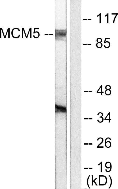 MCM5 Antibody (aa21-70)