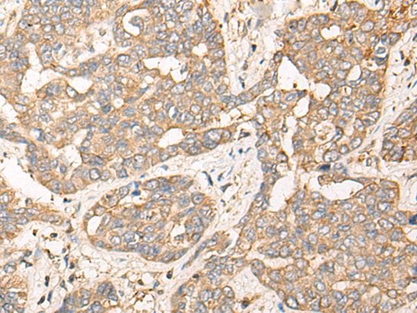 CPNE3 Antibody