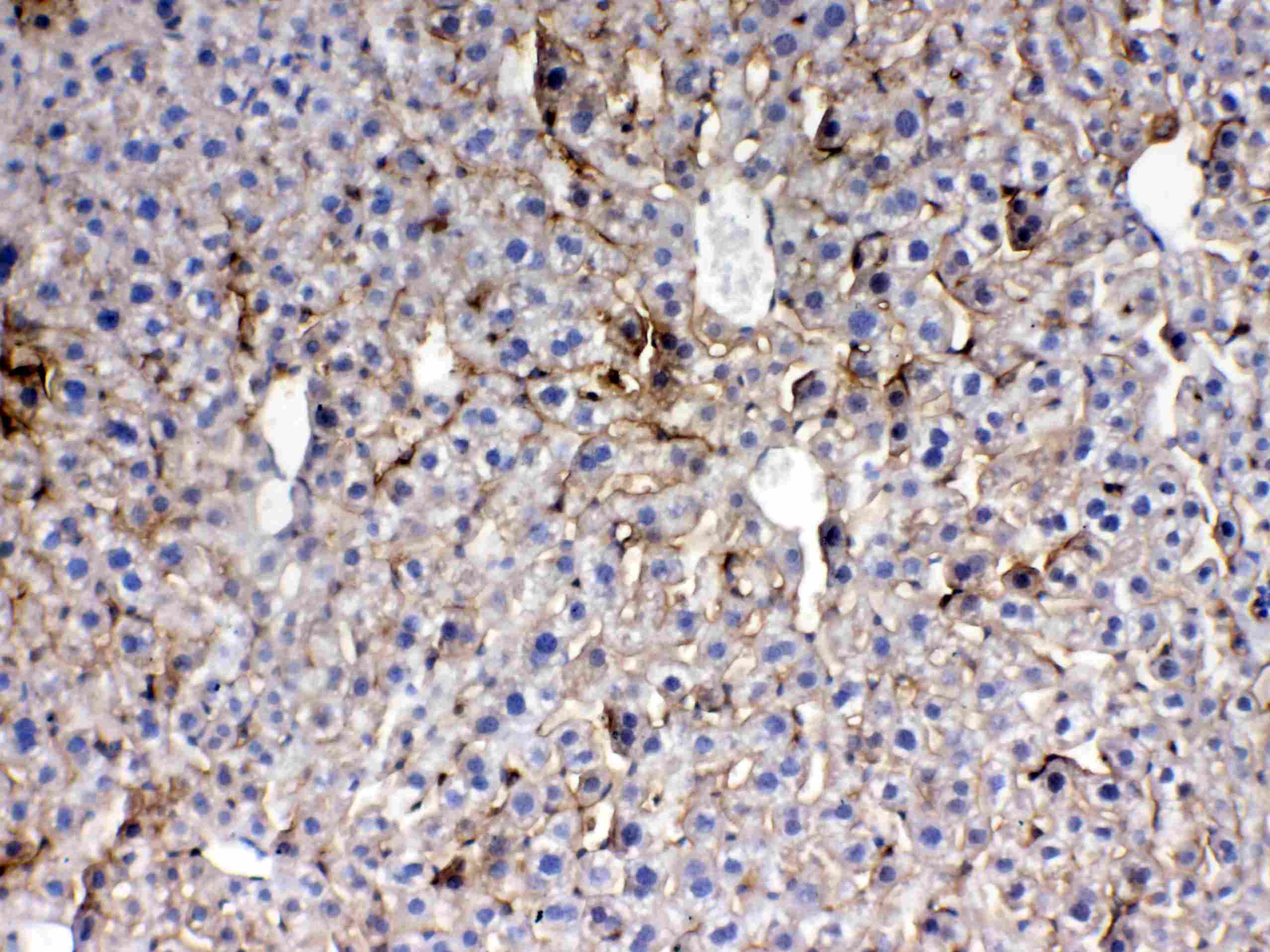 THPO / TPO / Thrombopoietin Antibody
