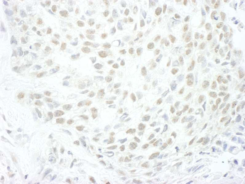 ENL / MLLT1 Antibody (aa325-375)