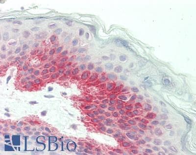 GFPT2 Antibody (aa611-660)