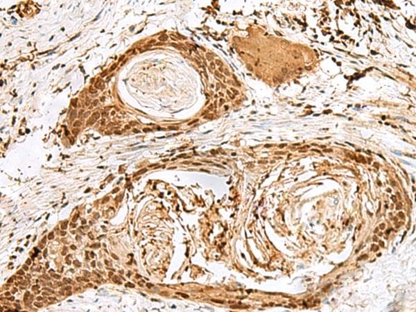 Polyclonal Rabbit anti-Human SNAPC1 Antibody (IHC)