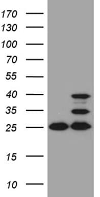 UQCRFS1 Antibody (aa79-274, clone OTI4H8)