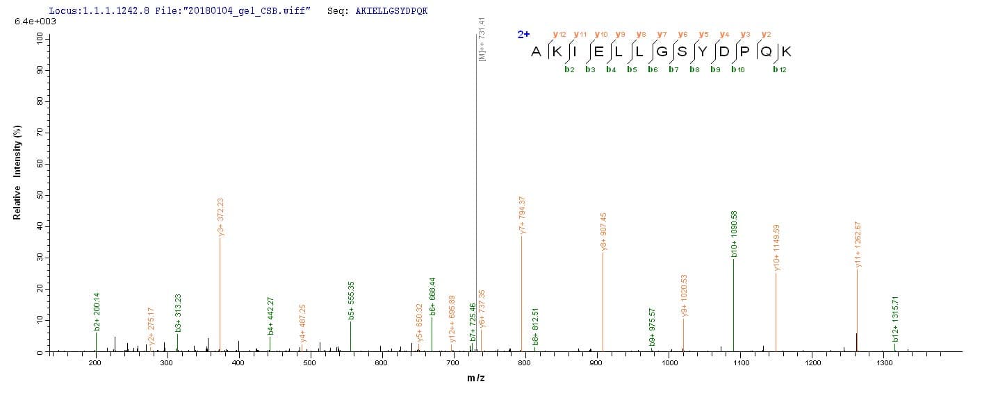 Human ACP1 / Acid Phosphatase Protein (Recombinant)