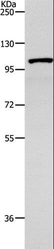 TNK2 / ACK1 Antibody