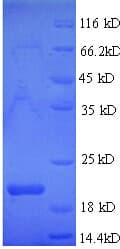 Drosophila melanogaster Bursicon Protein (Recombinant His)