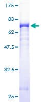 Human GSDMB / Gasdermin-Like Protein (Recombinant GST)