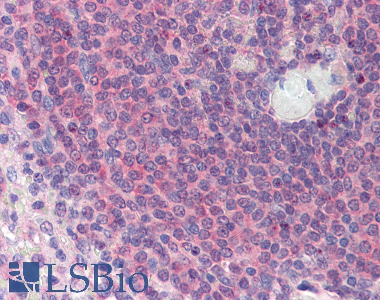 ARA55 / HIC-5 Antibody (N-Terminus)