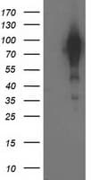 BCAR1 / p130Cas Antibody (clone OTI3A5)