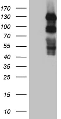 Monoclonal Mouse anti-Human PLK4 / SAK Antibody (clone OTI3B10, Carrier-free, aa307-612, WB)