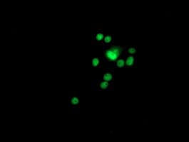 GSTT2 Antibody (clone OTI6C4)