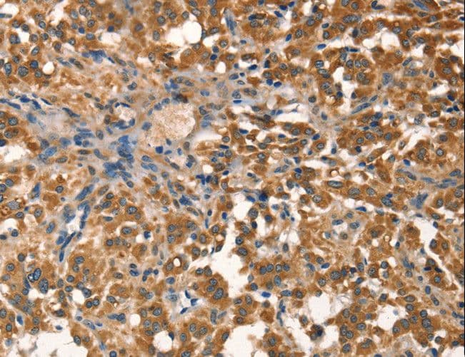 AGO1 / EIF2C Antibody