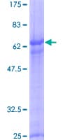 Human RHOXF2 Protein (Recombinant GST)
