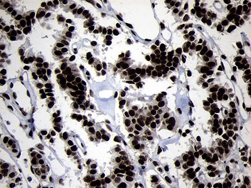 Monoclonal Mouse anti-Human HOXC4 Antibody (clone OTI2D5, IHC, WB)