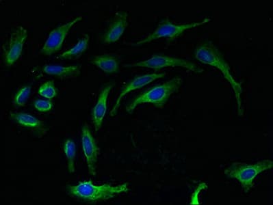 IHC-plus™ Polyclonal Rabbit anti-Human RPL27 / Ribosomal Protein L27 Antibody (IHC, WB)
