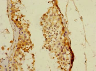 PDE4DIP / MMGL Antibody
