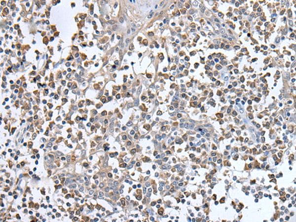 Polyclonal Rabbit anti-Human UBN1 / Ubinuclein 1 Antibody (IHC)