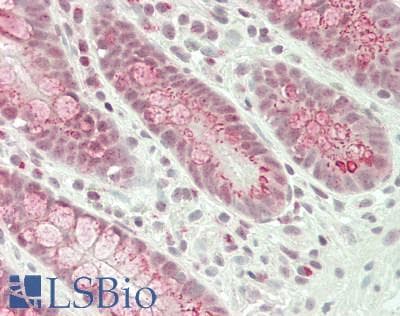 IHC-plus™ Polyclonal Rabbit anti-Human GOLGA2 / GM130 Antibody (IHC, IF, WB)