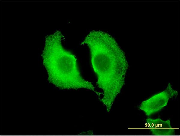 CTRB1 / Chymotrypsinogen B1 Antibody (clone 3C8)