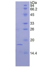 Mouse FGF1 / Acidic FGF Protein (Recombinant His)