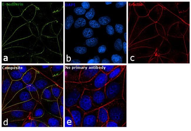 Monoclonal Mouse anti-Human CDH1 / E Cadherin Antibody (clone 67A4, FITC, IF)