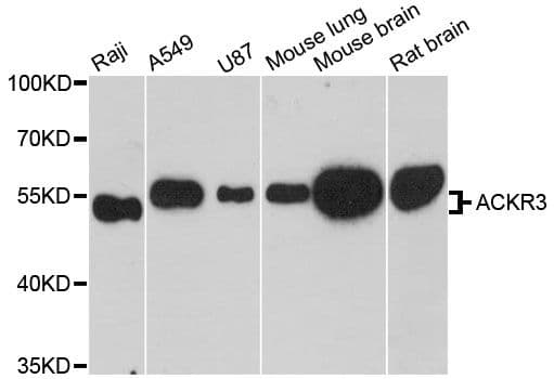 Polyclonal Rabbit anti-Human ACKR3 / CXCR7 Antibody (WB)