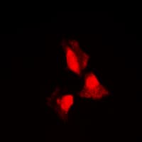 SGK1 / SGK Antibody (Internal)