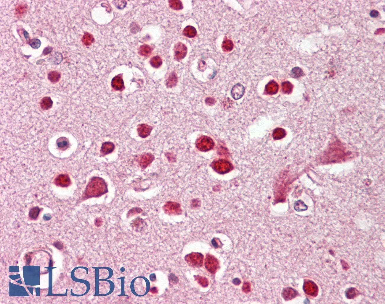 IHC-plus™ GRIK5 / KA2 Antibody (aa969-980)